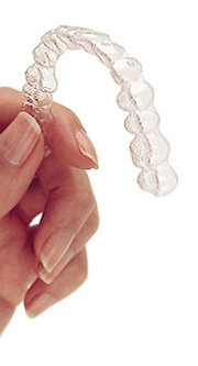 invisalign.jpg